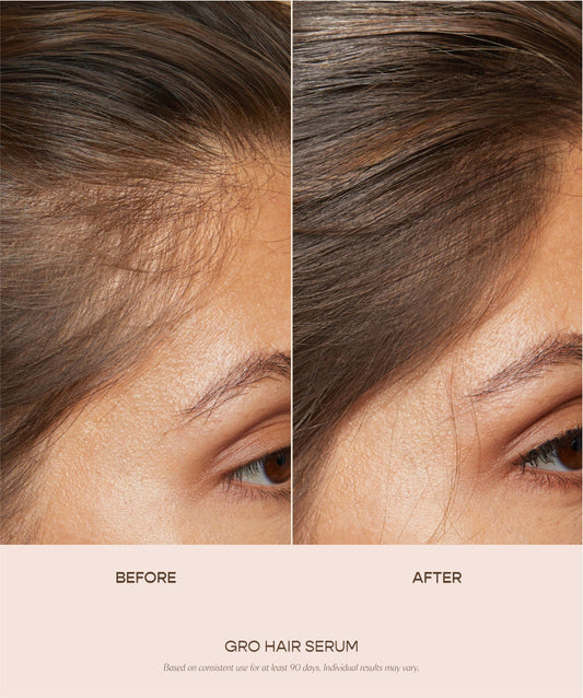 Vegamour GRO Hair Serum for Growth, Hair Thinning & Thicker Fuller Hair
